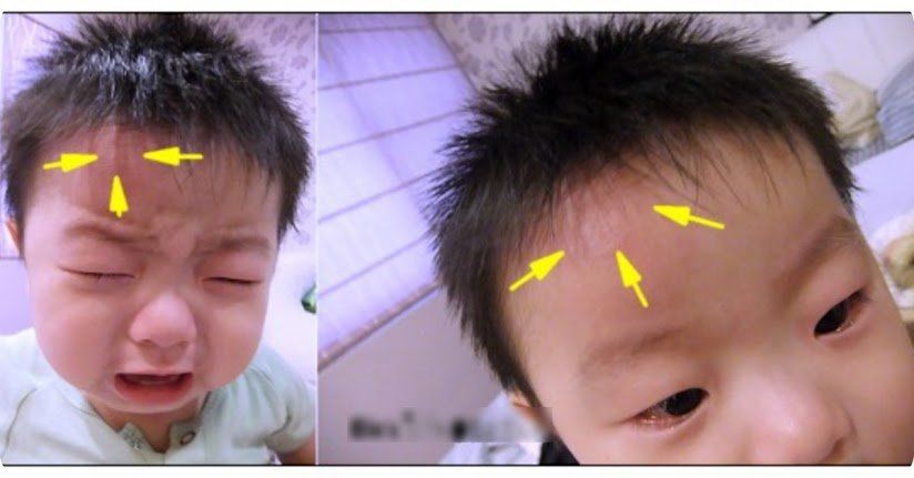 Vì sao trẻ hay tự đập đầu vào tường?