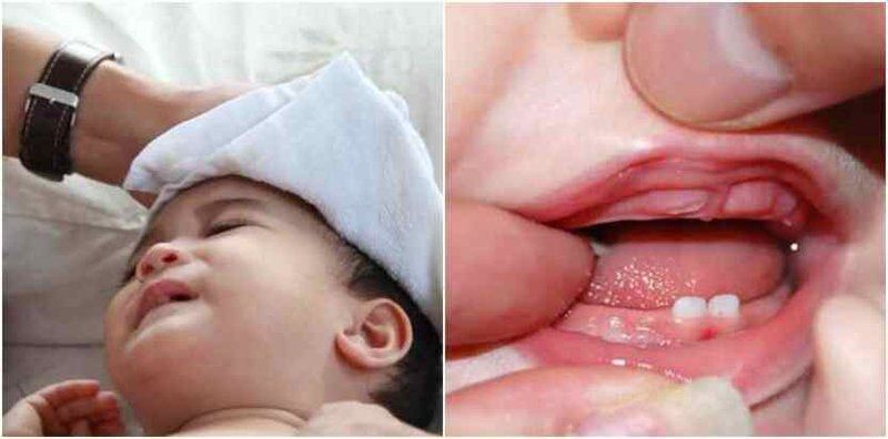 Chăm sóc trẻ bị sốt mọc răng