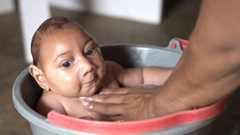 Teo não ở trẻ sơ sinh có nguy hiểm?