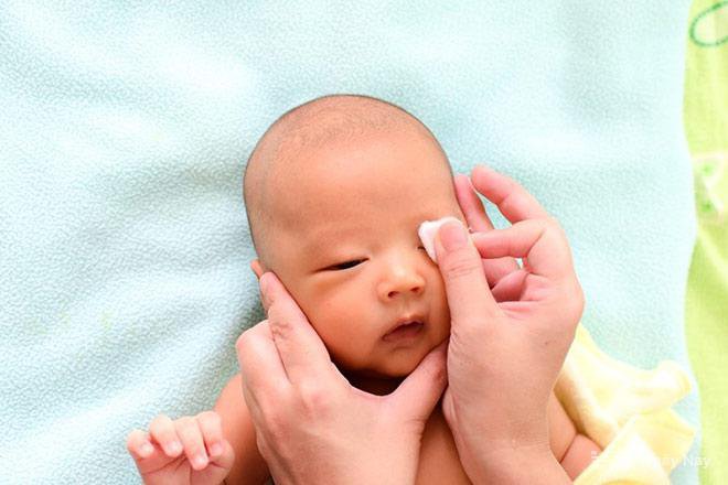 Tại sao trẻ sơ sinh bị sụp mí mắt?

