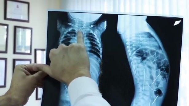 Đánh giá và xử trí ban đầu trẻ sơ sinh có tím (Phần 2)