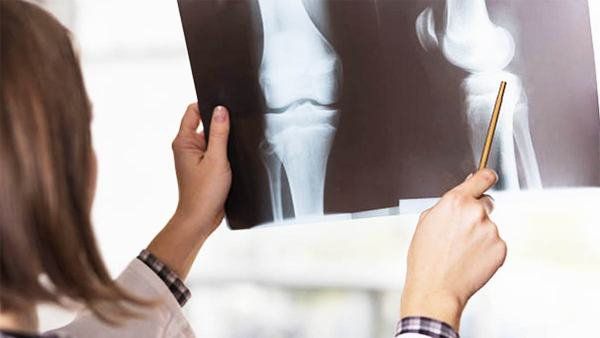 Trật xương bánh chè bẩm sinh và phẫu thuật điều trị