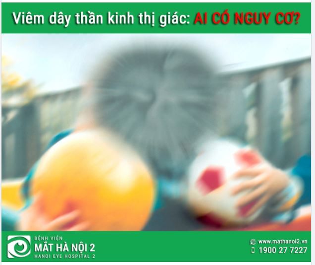 VIÊM DÂY THẦN KINH THỊ GIÁC: Ai có nguy cơ?