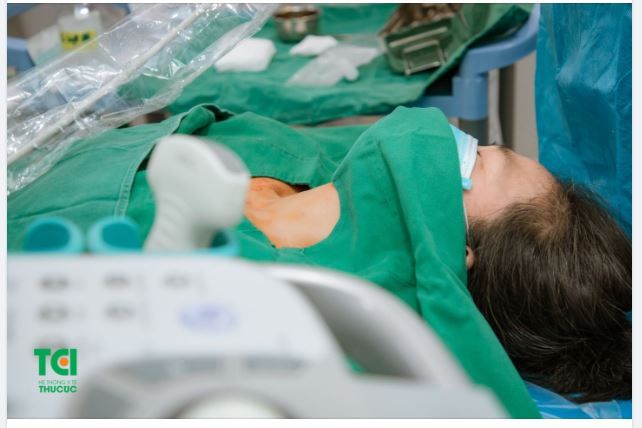 Trường hợp nào có thể sử dụng kỹ thuật đốt sóng cao tần điều trị u tuyến giáp lành tính?