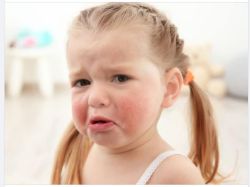 NHỮNG BỆNH DỊ ỨNG TRẺ CÓ NGUY CƠ GẶP PHẢI