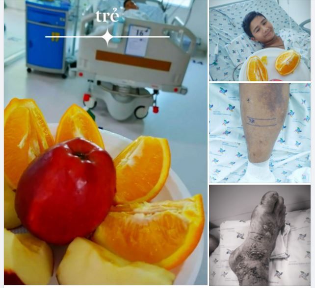 Cậu bé 15 tuổi ở Cần Thơ bị rắn lục đuôi đỏ cắn khi đang cắt cỏ sáng sớm