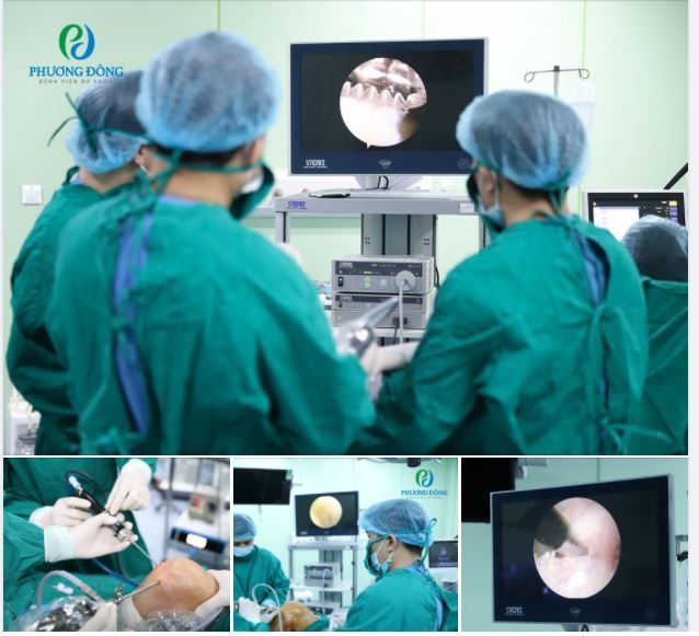 ĐIỀU TRỊ THOÁI HÓA KHỚP GỐI BẰNG PHẪU THUẬT NỘI SOI CÓ ƯU ĐIỂM GÌ?