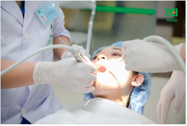 NHỔ 2 RĂNG KHÔN CÙNG LÚC CÓ ĐƯỢC KHÔNG?