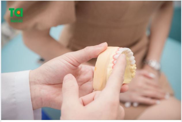4 YẾU TỐ ẢNH HƯỞNG ĐẾN ĐỘ BỀN CỦA MIẾNG DÁN RĂNG SỨ