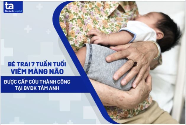 Bé trai 7 tuần tuổi bị viêm màng não. Làm thế nào để phòng ngừa sớm và điều trị kịp thời cho trẻ?