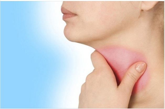TẠI SAO MÙA HÈ BẠN DỄ BỊ VIÊM HỌNG HƠN?