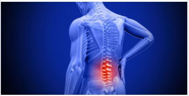 Bị thoát vị đĩa đệm có NÊN chạy bộ hay KHÔNG?