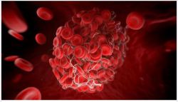 NHẬN DIỆN “KẺ THÙ NGUY HIỂM” – CỤC MÁU ĐÔNG