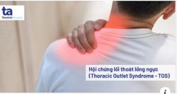 Hội chứng lối thoát lồng ngực