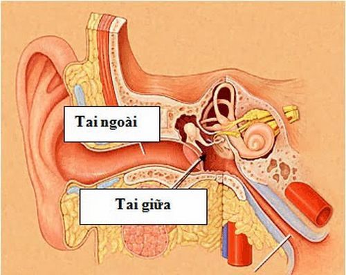 Bệnh viêm tai giữa là gì? - Bệnh viện Bạch Mai