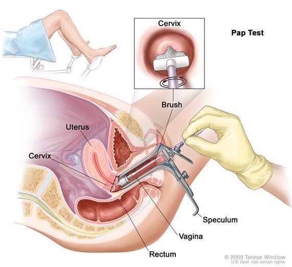 Những điều cần biết về vắc-xin HPV - Vắc-xin phòng ngừa ung thư cổ tử cung