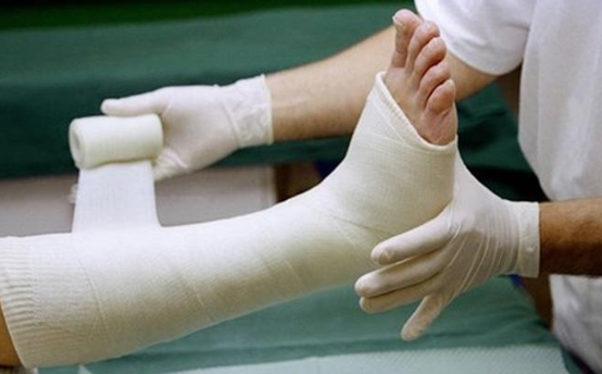 Làm gì khi bị gãy xương chân?