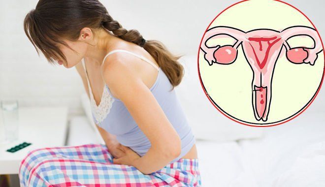 Chụp số hóa xóa nền và nút giãn tĩnh mạch buồng trứng