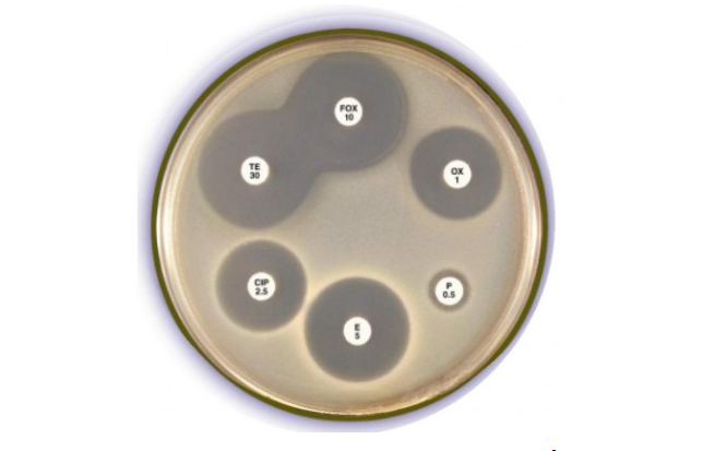 Xét nghiệm phân để làm gì?