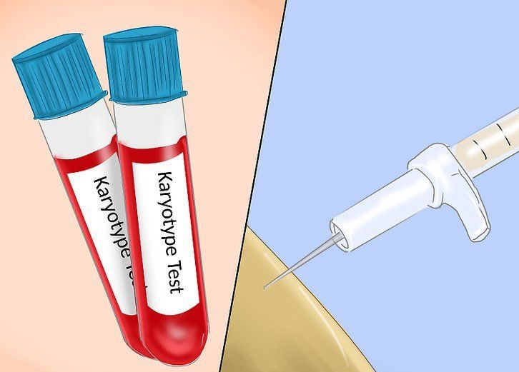 3 xét nghiệm nhiễm sắc thể trong thai kỳ