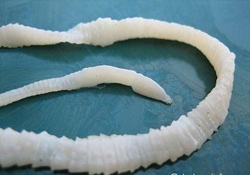 Dấu hiệu khi cơ thể nhiễm ký sinh trùng