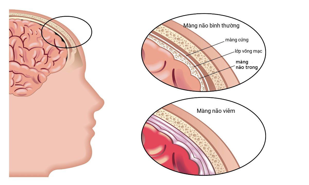 Xét nghiệm bệnh lyme