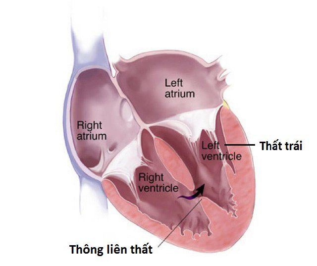 Gây mê hồi sức trong bệnh cơ tim thiếu máu và tái tưới máu mạch vành - Phần 2