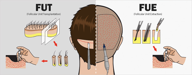 Hiểu về rụng tóc - Những điều cơ bản