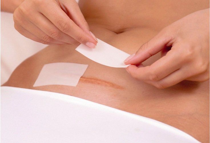 Chăm sóc sức khỏe thời kỳ hậu sản