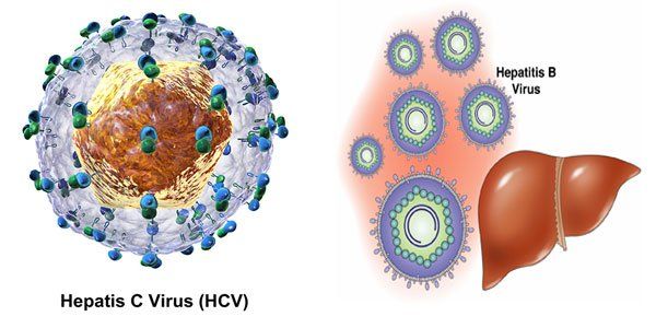 Bệnh viêm gan do virus là gì?
