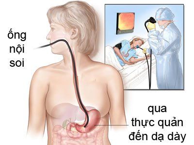 Quy trình siêu âm nội soi