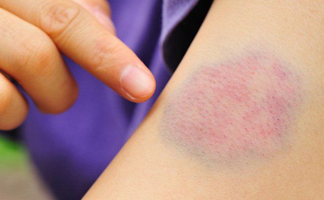 Tế bào máu sinh ra ở đâu?