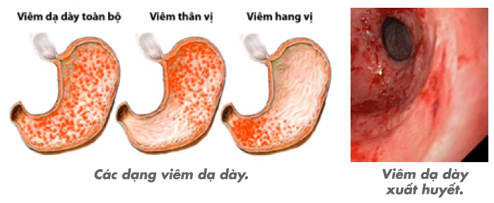 Xét nghiệm BUN là gì? Ý nghĩa xét nghiệm BUN