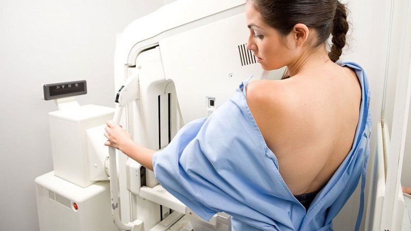 Lợi ích khi chụp nhũ ảnh