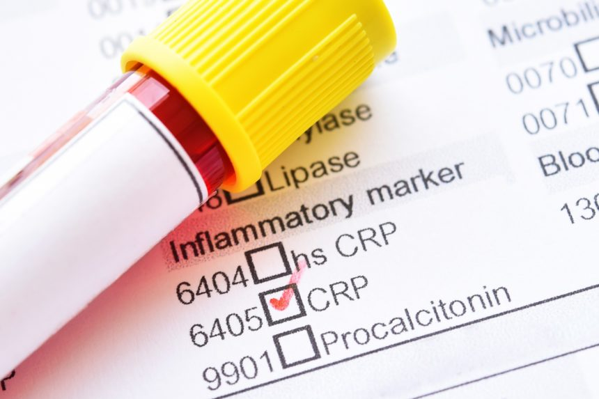 Xét nghiệm CRP là gì và có vai trò thế nào?