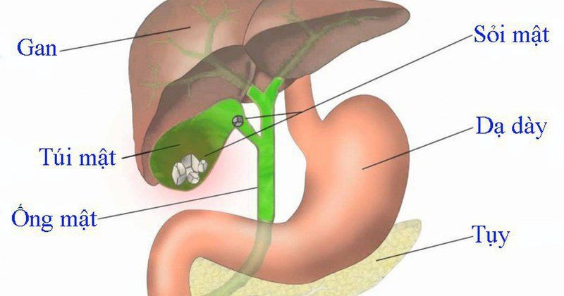 Viêm tụy mạn: Điều trị thế nào?