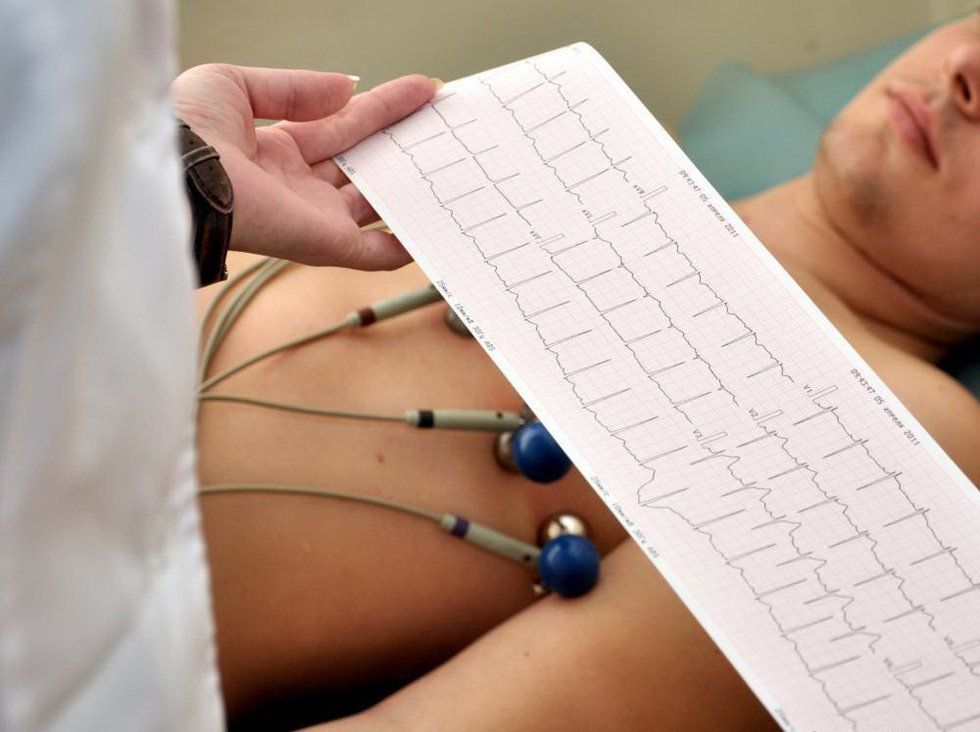 Chẩn đoán nhồi máu cơ tim bằng điện tâm đồ