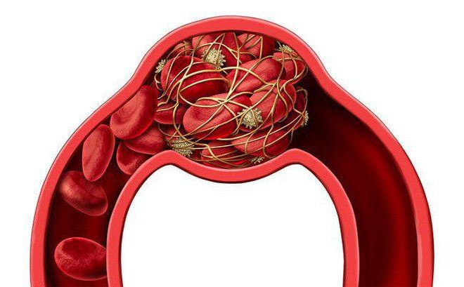 Hồi phục sau sinh mổ