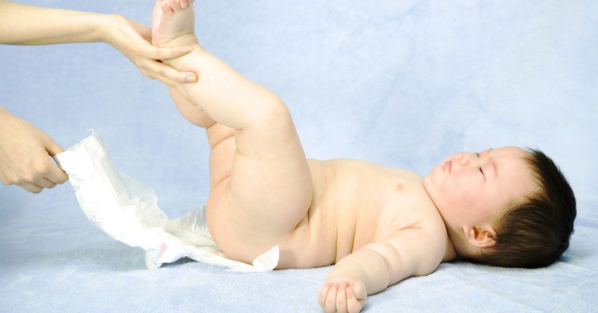 Bệnh vảy nến ở trẻ sơ sinh có nguy hiểm?