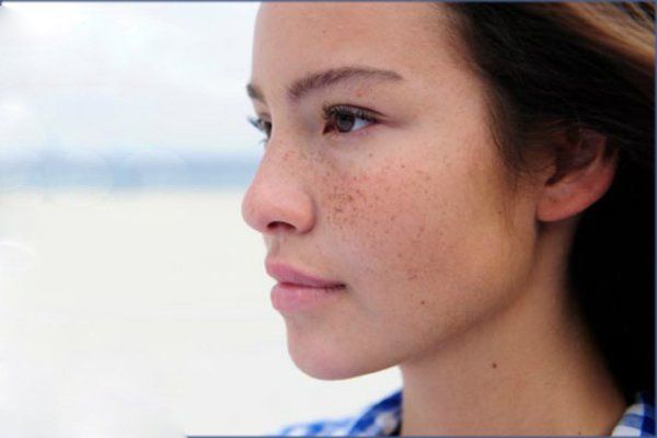 Melanin bảo vệ chúng ta khỏi ung thư da nhưng cũng có thể gây ra nó