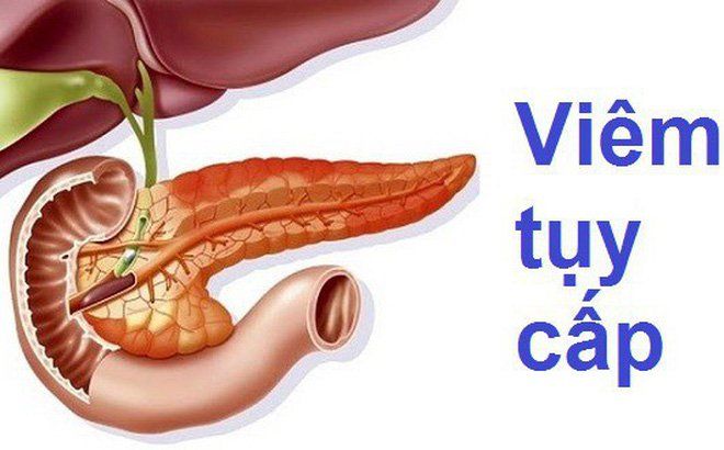 Viêm phúc mạc cấp: Cần phẫu thuật sớm