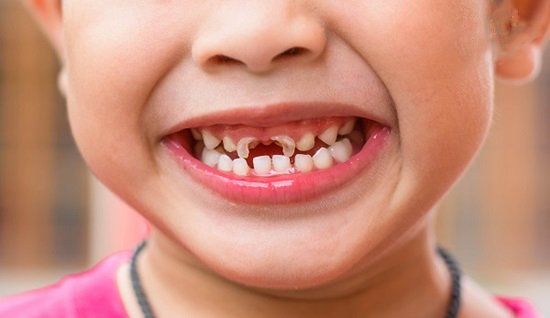 Vai trò của chụp X quang răng toàn cảnh