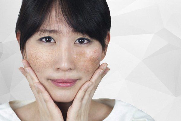Melanin bảo vệ chúng ta khỏi ung thư da nhưng cũng có thể gây ra nó