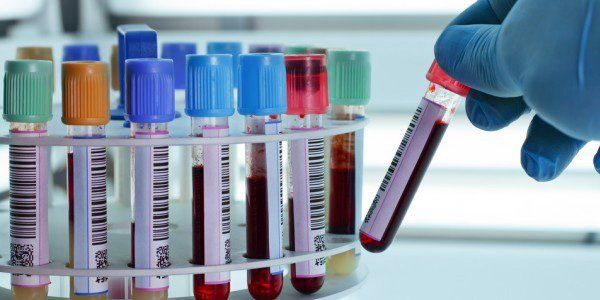 Xét nghiệm chẩn đoán mụn rộp sinh dục