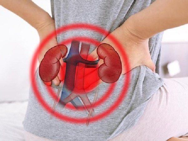 Phẫu thuật nội soi sau phúc mạc lấy sỏi niệu quản