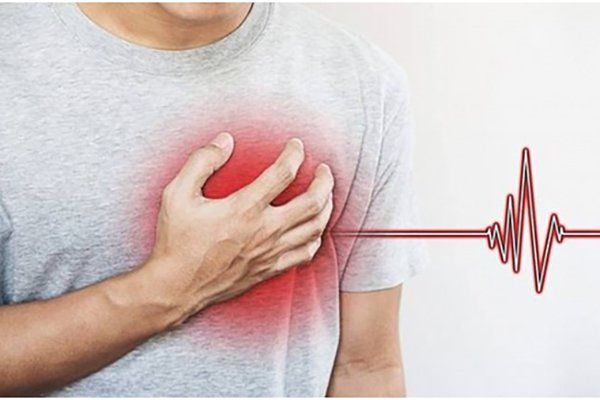 Phân biệt 5 type nhồi máu cơ tim
