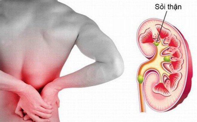 Nguyên nhân và triệu chứng viêm kẽ thận mạn
