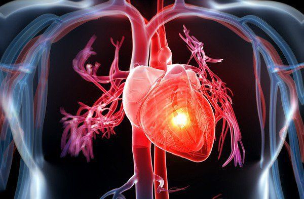 3 loại xạ hình tim mạch thường gặp