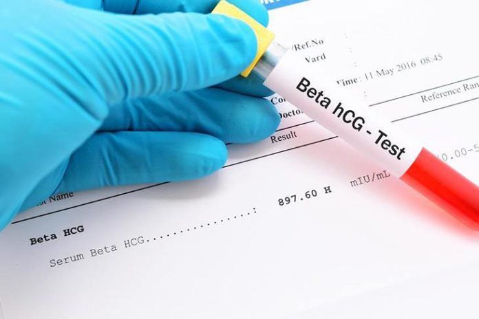 Xét nghiệm beta HCG sau 14 ngày chuyển phôi: Những điều cần biết