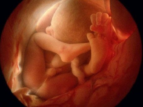 Siêu âm 4D thời điểm nào tốt nhất?